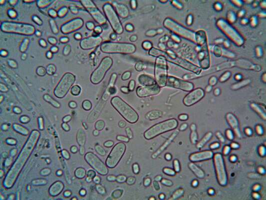 Microben